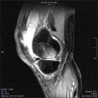 Magnetresonanztomografie (Magnetic Resonance Imaging)